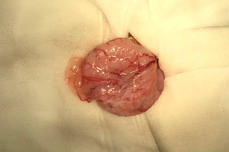 手術写真（膀胱）