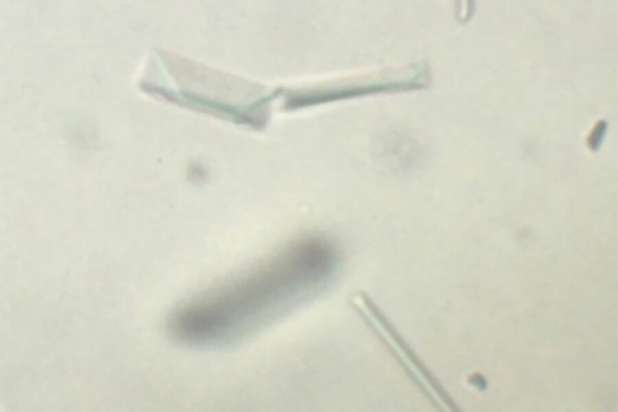 顕微鏡画像 尿検査